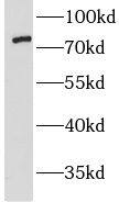 Western Blot: LMF2 Antibody - BSA Free [NBP3-46015] - HeLa cells were subjected to SDS PAGE followed by western blot with (LMF2 antibody) at dilution of 1:800
