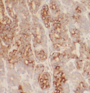 Immunohistochemistry LMF1 Antibody - BSA Free