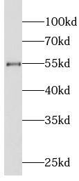 Western Blot: LIPH Antibody - BSA Free [NBP3-46019] - A549 cells were subjected to SDS PAGE followed by western blot with (LIPH antibody) at dilution of 1:500