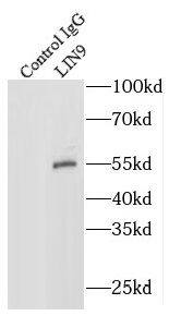 Immunoprecipitation: LIN9 Antibody - BSA Free [NBP3-46021] - IP Result of anti-LIN9 (IP:, 4ug; Detection: 1:1000) with HEK-293 cells lysate 1100ug.