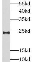 Western Blot LIN7B Antibody - BSA Free