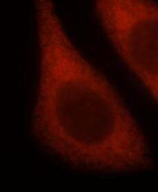 Immunocytochemistry/ Immunofluorescence: LHPP Antibody - BSA Free [NBP3-46025] - Immunofluorescent analysis of Hela cells, using LHPP antibody  at 1:25 dilution and Rhodamine-labeled goat anti-rabbit IgG (red)