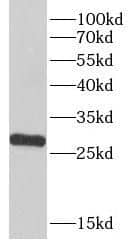 Western Blot: LHPP Antibody - BSA Free [NBP3-46025] - Human brain tissue were subjected to SDS PAGE followed by western blot with (LHPP antibody) at dilution of 1:500