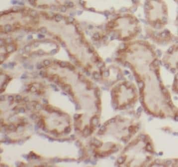 Immunohistochemistry: LHPP Antibody - BSA Free [NBP3-46025] - Immunohistochemistry of paraffin-embedded human kidney using (LHPP antibody) at dilution of 1:100