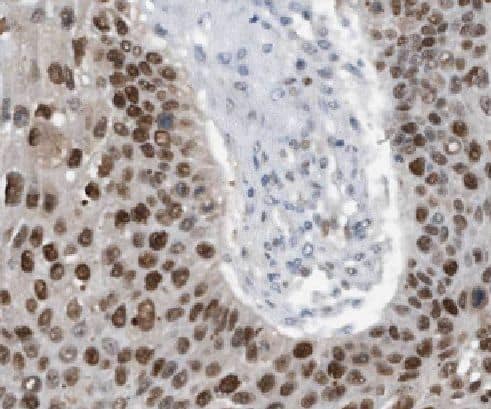 Immunohistochemistry Lgi3 Antibody - BSA Free