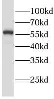 Western Blot Lgi3 Antibody - BSA Free