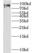 Western Blot LEPREL2 Antibody - BSA Free