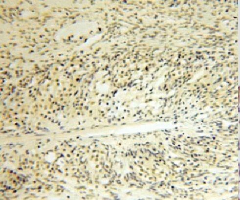 Immunohistochemistry: LDB1 Antibody - BSA Free [NBP3-46034] - Immunohistochemistry of paraffin-embedded human ovary using (LDB1 antibody) at dilution of 1:50