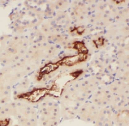 Immunohistochemistry LAD1 Antibody - BSA Free