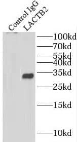 Immunoprecipitation: lactamase, beta 2 Antibody - BSA Free [NBP3-46047] - IP Result of anti-lactamase, beta 2 (IP:, 3ug; Detection: 1:700) with A549 cells lysate 520ug.