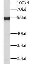 Western Blot: IFIT2 Antibody - BSA Free [NBP3-46052] - A431 cells were subjected to SDS PAGE followed by western blot with (IFIT2 Antibody) at dilution of 1:300