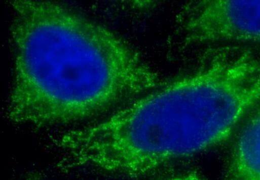 Immunocytochemistry/ Immunofluorescence: IFIT2 Antibody - BSA Free [NBP3-46052] - Immunofluorescent analysis of HepG2 cells using  (IFIT2 antibody) at dilution of 1:25 and Alexa Fluor 488-conjugated Goat Anti-Rabbit IgG(H+L)