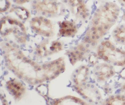 Immunohistochemistry IFIT2 Antibody - BSA Free