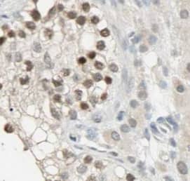 Immunohistochemistry: IFIT1B Antibody - BSA Free [NBP3-46053] - Immunohistochemistry of paraffin-embedded human testis tissue slide using (IFIT1B Antibody) at dilution of 1:50