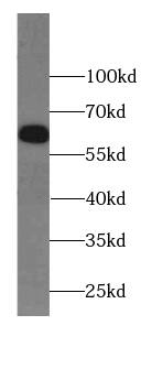 Western Blot: IFIT1B Antibody - BSA Free [NBP3-46053] - RAW 264.7 cells were subjected to SDS PAGE followed by western blot with (IFIT1B Antibody) at dilution of 1:300