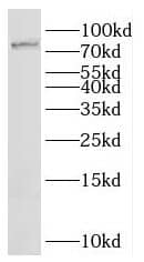 Western Blot: IFFO Antibody - BSA Free [NBP3-46055] - Mouse brain tissue were subjected to SDS PAGE followed by western blot with (IFFO Antibody) at dilution of 1:1000