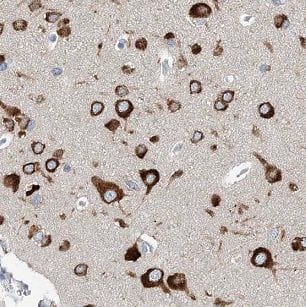 Immunohistochemistry: IFFO Antibody - BSA Free [NBP3-46055] - Immunohistochemistry of paraffin-embedded human brain using (IFFO antibody) at dilution of 1:100