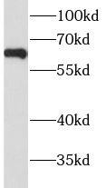 Western Blot: Hyaluronidase 4/HYAL4 Antibody - BSA Free [NBP3-46062] - Mouse testis tissue were subjected to SDS PAGE followed by western blot with (Hyaluronidase 4/HYAL4 Antibody) at dilution of 1:300