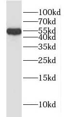 Western Blot HYAL3 Antibody - BSA Free