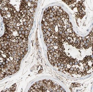 Immunohistochemistry HYAL3 Antibody - BSA Free