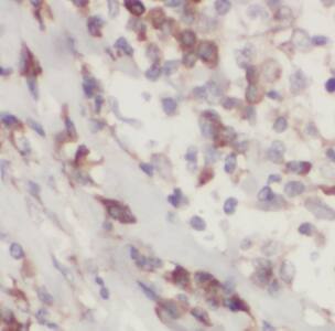 Immunohistochemistry HuC Antibody - BSA Free