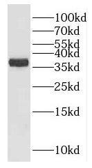 Western Blot: HuC Antibody - BSA Free [NBP3-46066] - Human brain tissue were subjected to SDS PAGE followed by western blot with (HuC antibody) at dilution of 1:200