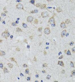 Immunohistochemistry: 5-HT3A Antibody - BSA Free [NBP3-46068] - Immunohistochemistry of paraffin-embedded rat brain using ( 5-HT3A Antibody) at dilution of 1:50