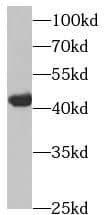 Western Blot: HSDL2 Antibody - BSA Free [NBP3-46071] - HEK-293 cells were subjected to SDS PAGE followed by western blot with (HSDL2 antibody) at dilution of 1:500