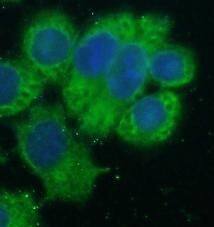 Immunocytochemistry/ Immunofluorescence: HSDL2 Antibody - BSA Free [NBP3-46071] - Immunofluorescent analysis of HeLa cells using  (HSDL2 antibody) at dilution of 1:50 and Alexa Fluor 488-conjugated Goat Anti-Rabbit IgG(H+L)