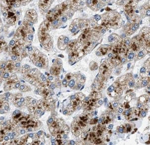 Immunohistochemistry HSDL1 Antibody - BSA Free