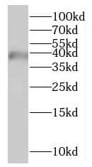 Western Blot HSDL1 Antibody - BSA Free