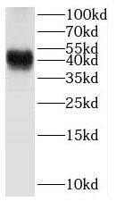 Western Blot: Beta Hydroxysteroid Dehydrogenase Antibody - BSA Free [NBP3-46074] - Human adrenal gland tissue were subjected to SDS PAGE followed by western blot with (Beta Hydroxysteroid Dehydrogenase antibody) at dilution of 1:1500