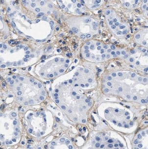 Immunohistochemistry: hydroxysteroid (17-beta) dehydrogenase 11 Antibody - BSA Free [NBP3-46076] - Immunohistochemistry of paraffin-embedded human kidney using (hydroxysteroid (17-beta) dehydrogenase 11 antibody) at dilution of 1:100
