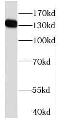 Western Blot HPS5 Antibody - BSA Free