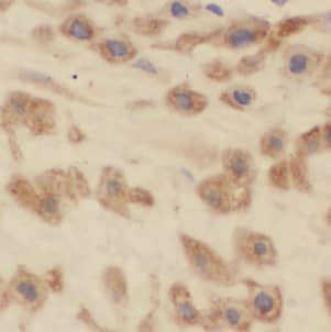 Immunohistochemistry HPS5 Antibody - BSA Free