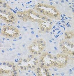 Immunohistochemistry HPS1 Antibody - BSA Free