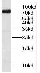 Western Blot HPS1 Antibody - BSA Free