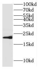 Western Blot: Hippocalcin like 4 Antibody - BSA Free [NBP3-46088] - Human brain tissue were subjected to SDS PAGE followed by western blot with (Hippocalcin like 4 antibody) at dilution of 1:500