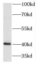 Western Blot: HOXA9 Antibody - BSA Free [NBP3-46090] - Mouse colon tissue were subjected to SDS PAGE followed by western blot with ( HOXA9 Antibody) at dilution of 1:600