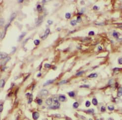 Immunohistochemistry PSMC3IP Antibody - BSA Free
