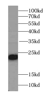 Western Blot PSMC3IP Antibody - BSA Free
