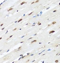 Immunohistochemistry: hnRNP-R Antibody - BSA Free [NBP3-46096] - Immunohistochemistry of paraffin-embedded rat brain using (hnRNP-R antibody) at dilution of 1:100