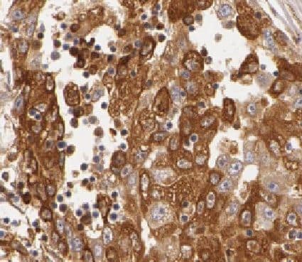Immunohistochemistry HMP19 Antibody - BSA Free