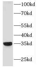 Western Blot: HLA DRB4 Antibody - BSA Free [NBP3-46108] - Jurkat cells were subjected to SDS PAGE followed by western blot with (HLA DRB4 antibody) at dilution of 1:600
