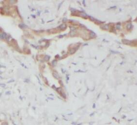 Immunohistochemistry: Hikeshi Antibody - BSA Free [NBP3-46119] - Immunohistochemistry of paraffin-embedded human lung using (Hikeshi antibody) at dilution of 1:100