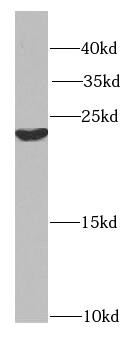 Western Blot: Hikeshi Antibody - BSA Free [NBP3-46119] - PC-3 cells were subjected to SDS PAGE followed by western blot with (Hikeshi antibody) at dilution of 1:500