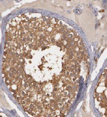 Immunohistochemistry HIGD1A Antibody - BSA Free