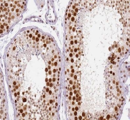 Immunohistochemistry: HEXIM2 Antibody - BSA Free [NBP3-46123] - Immunohistochemistry of paraffin-embedded human testis tissue slide using (HEXIM2 Antibody) at dilution of 1:50