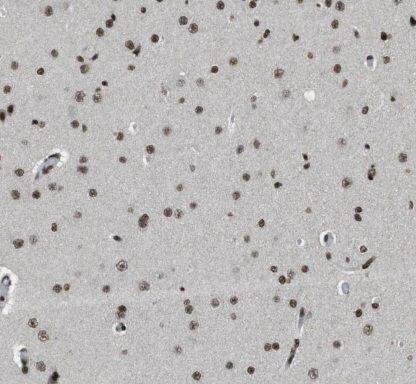 Immunohistochemistry HESX1 Antibody - BSA Free