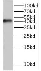 Western Blot: HES5 Antibody - BSA Free [NBP3-46125] - Rat brain tissue were subjected to SDS PAGE followed by western blot with (HES5 Antibody) at dilution of 1:300